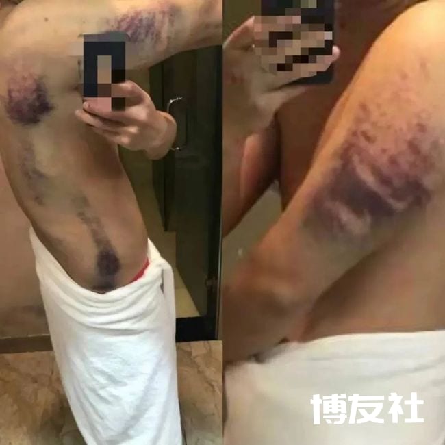 吓人！大竹小伙亲述缅甸北打工的恐怖遭遇…